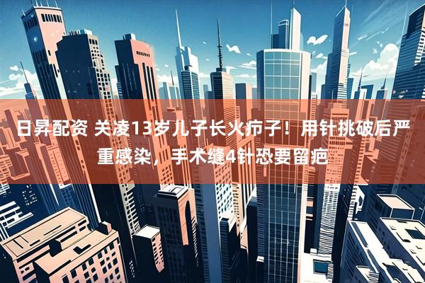 日昇配资 关凌13岁儿子长火疖子！用针挑破后严重感染，手术缝4针恐要留疤